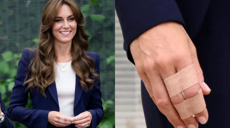 What Happened To Princess Kate's Hand And Why Is She Wearing A Bandage